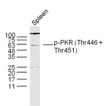 Phospho-PKR (Thr446 + Thr451) Rabbit Polyclonal Antibody