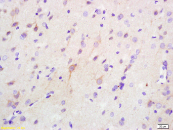 Phospho-PKR (Thr446 + Thr451) Rabbit Polyclonal Antibody