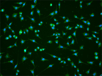 PHD2 Rabbit Polyclonal Antibody