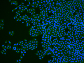 CD162 Rabbit Polyclonal Antibody