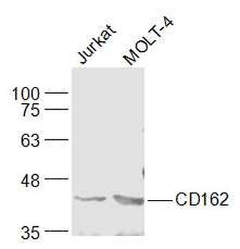 CD162 Rabbit Polyclonal Antibody