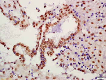 Phospho-PTEN (Ser380 + Thr382 + Thr383) Rabbit Polyclonal Antibody