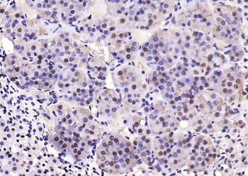 Phospho-PTEN (Ser380 + Thr382 + Thr383) Rabbit Polyclonal Antibody