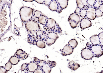 Phospho-PTEN (Ser380 + Thr382 + Thr383) Rabbit Polyclonal Antibody