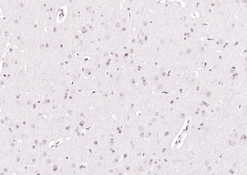 Phospho-PTEN (Ser380 + Thr382 + Thr383) Rabbit Polyclonal Antibody