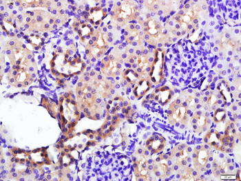 Raptor Rabbit Polyclonal Antibody