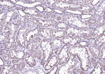 ALDH1A2 Rabbit Polyclonal Antibody