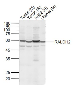 ALDH1A2 Rabbit Polyclonal Antibody