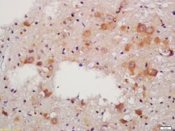 ALDH1A2 Rabbit Polyclonal Antibody