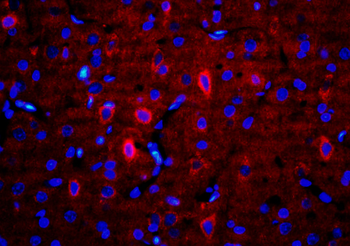 ALDH1A2 Rabbit Polyclonal Antibody