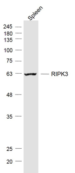 RIPK3 Rabbit Polyclonal Antibody
