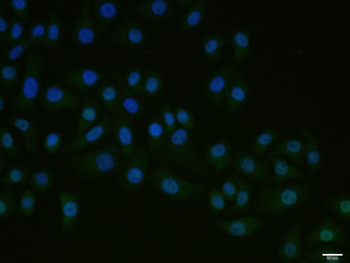 RORC Rabbit Polyclonal Antibody