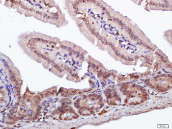 RORC Rabbit Polyclonal Antibody