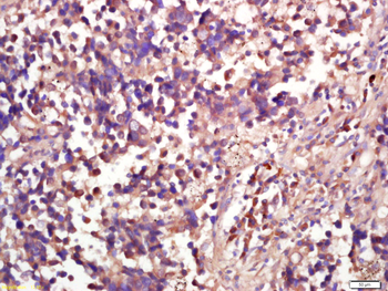 RSK2 Rabbit Polyclonal Antibody