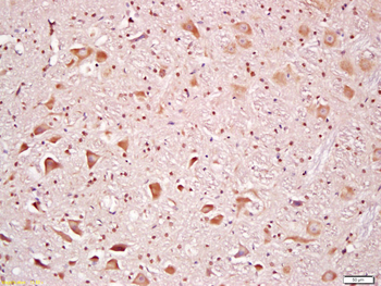 RSK2 Rabbit Polyclonal Antibody