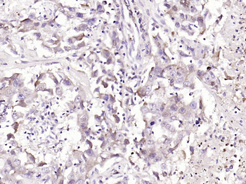 S100-A9 Rabbit Polyclonal Antibody