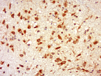 Phospho-INPPL1 (Ser576) Rabbit Polyclonal Antibody
