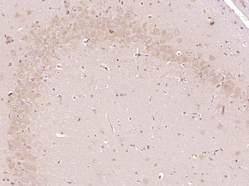 Phospho-PTPN11 (Tyr542) Rabbit Polyclonal Antibody