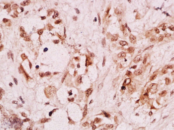 ZEB1/NIL2A Rabbit Polyclonal Antibody