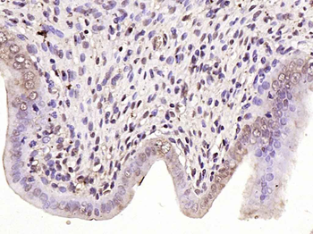 ZEB1/NIL2A Rabbit Polyclonal Antibody