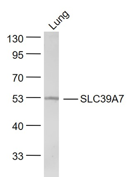 SLC39A7 Rabbit Polyclonal Antibody