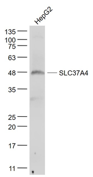 SLC37A4 Rabbit Polyclonal Antibody