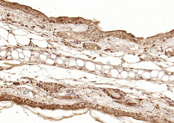 Phospho-Smad3 (Ser423 + Ser425) Rabbit Polyclonal Antibody