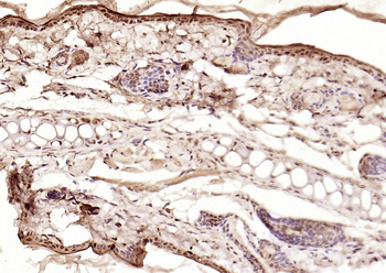 Phospho-Smad3 (Ser423 + Ser425) Rabbit Polyclonal Antibody