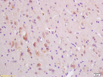 Synaptotagmin 5 Rabbit Polyclonal Antibody