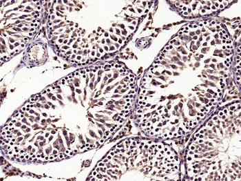 StAR Rabbit Polyclonal Antibody