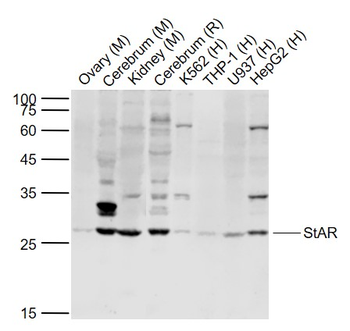 StAR Rabbit Polyclonal Antibody