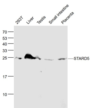 STARD5 Rabbit Polyclonal Antibody
