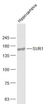 SUR1 Rabbit Polyclonal Antibody