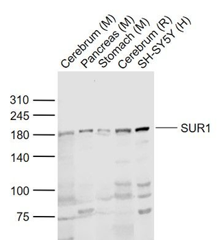 SUR1 Rabbit Polyclonal Antibody