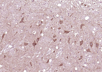 Synapsin 1 Rabbit Polyclonal Antibody