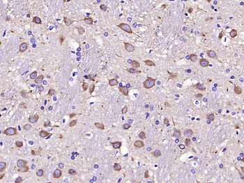 Ephrin B2 Recombinant Rabbit Monoclonal Antibody