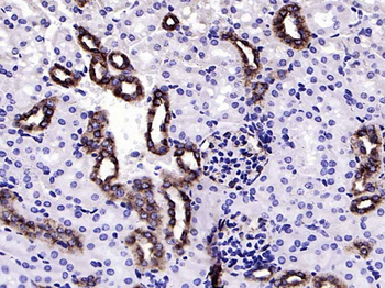 Ephrin B2 Recombinant Rabbit Monoclonal Antibody