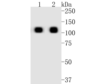 ACE2 Recombinant Rabbit Monoclonal Antibody