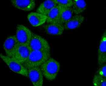 ACE2 Recombinant Rabbit Monoclonal Antibody