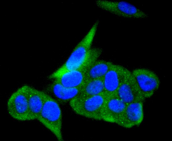 ACE2 Recombinant Rabbit Monoclonal Antibody