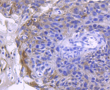 ACE2 Recombinant Rabbit Monoclonal Antibody