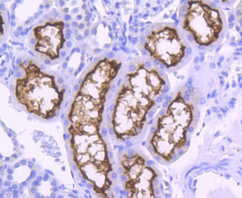 ACE2 Recombinant Rabbit Monoclonal Antibody