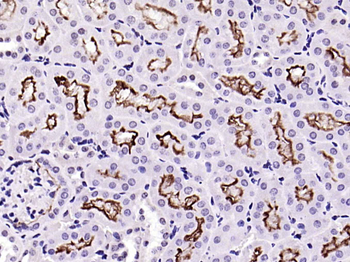 ACE2 Recombinant Rabbit Monoclonal Antibody