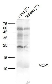 MCP1 Rabbit Polyclonal Antibody