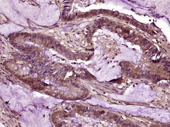 RAF1 Rabbit Polyclonal Antibody