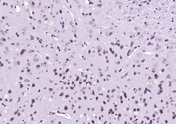 Glutathione Synthetase Rabbit Polyclonal Antibody
