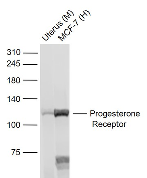 Progesterone Receptor Rabbit Polyclonal Antibody