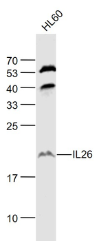 IL26 Rabbit Polyclonal Antibody