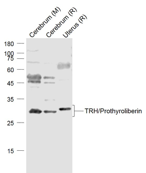 TRH/Prothyroliberin Rabbit Polyclonal Antibody