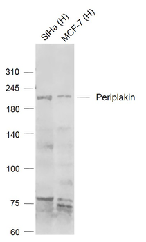 Periplakin Rabbit Polyclonal Antibody